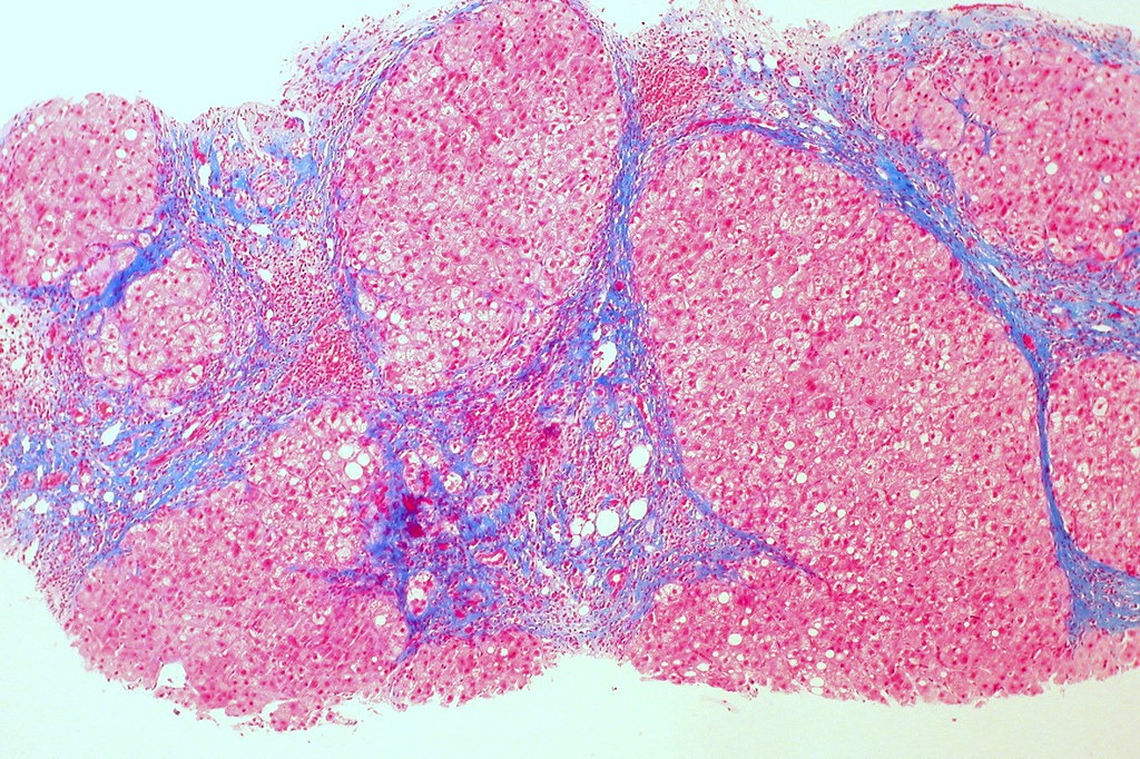 Liver tissue under the microscope