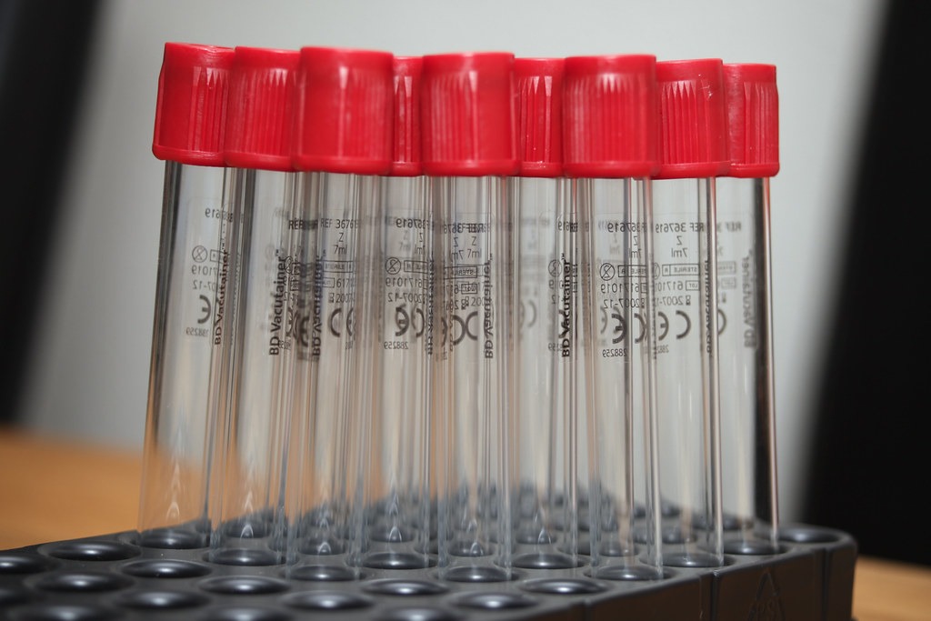 Row of test tubes with red caps
